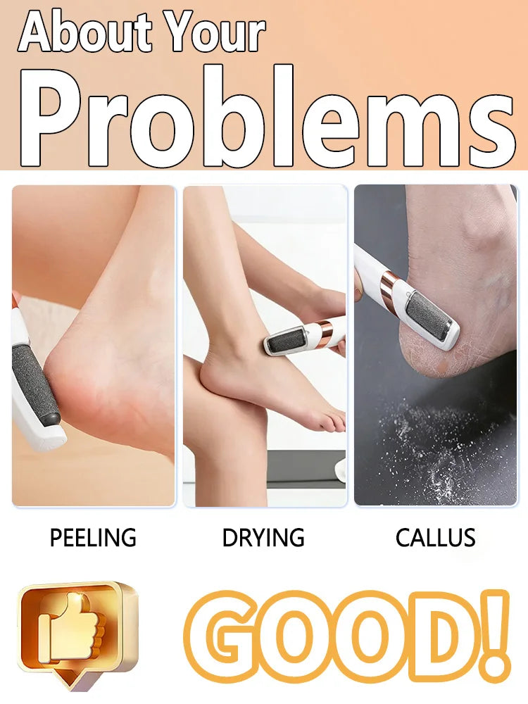 Electric Callus Remover for Feet,Electric foot grinder,Foot Exfoliator Foot Scrubber Pedicure Tools,Removes Dry Skin.Unisex